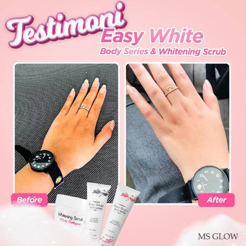 MS Glow Hand Body 100% original bisa cod