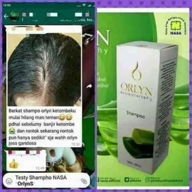 Shampo orlyn nasa