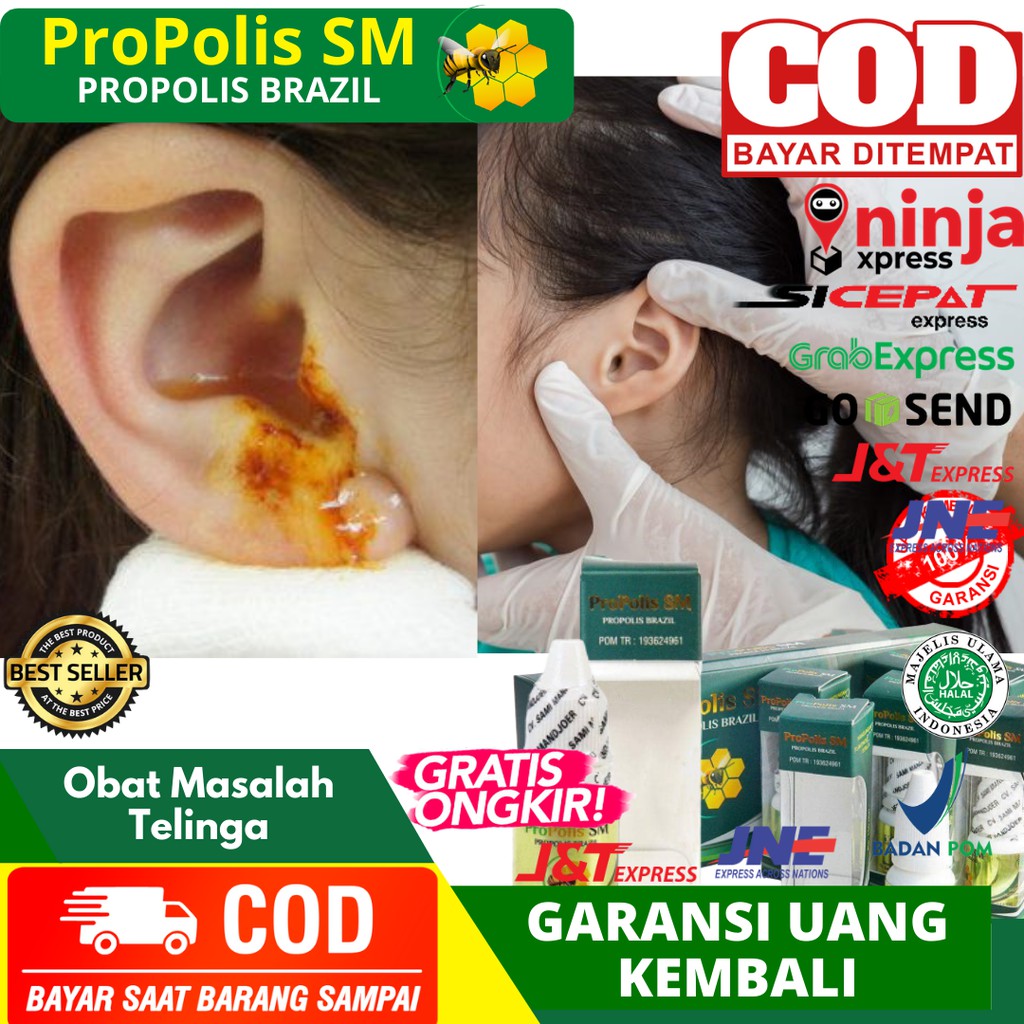 Obat Telinga Congek Untuk Anak - Congek Menahun - Telinga Bernanah - Obat Masalah Telinga - Propolis