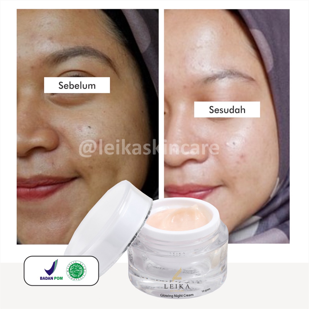 Ampuh! Krim untuk Mengurangi Minyak di Kulit Wajah Cream Menghilangkan Muka Berminyak Krim Muka untuk Kulit Berminyak Ampuh Penghilang Wajah Berminyak Glowing Night Cream Leika Skincare 10gr Resmi BPOM dan Halal