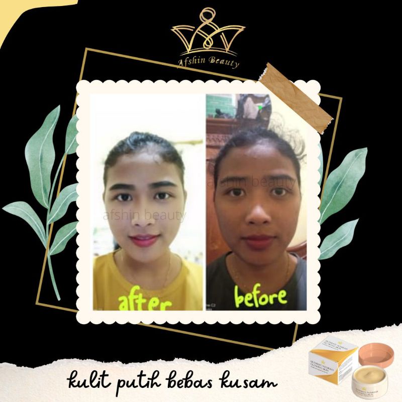 (READY) ULTIMATE NOURISH GLOWING SKIN BPOM (100% ORIGINAL) BIKIN PUTIH BERSIH GLOWING ULTIMATE NOURISH GLOWING SKIN CREAM GLOWING SKIN ORIGINAL / MENGATASI JERAWAT DAN MENGHILANGKAN BEKAS JERAWAT