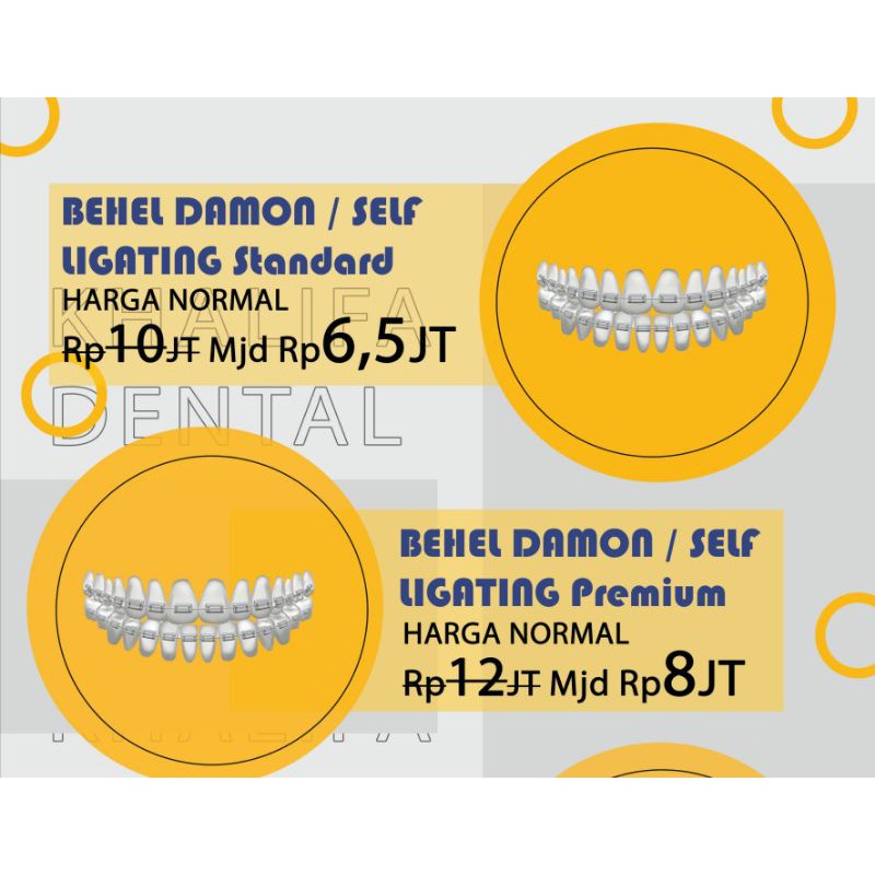 Kredit Behel Damon / Self Ligating Premium