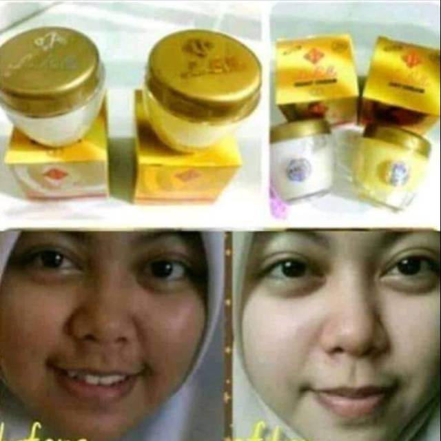 Cream Labella Cream Jerawat Pemutih Wajah Siang+mlm