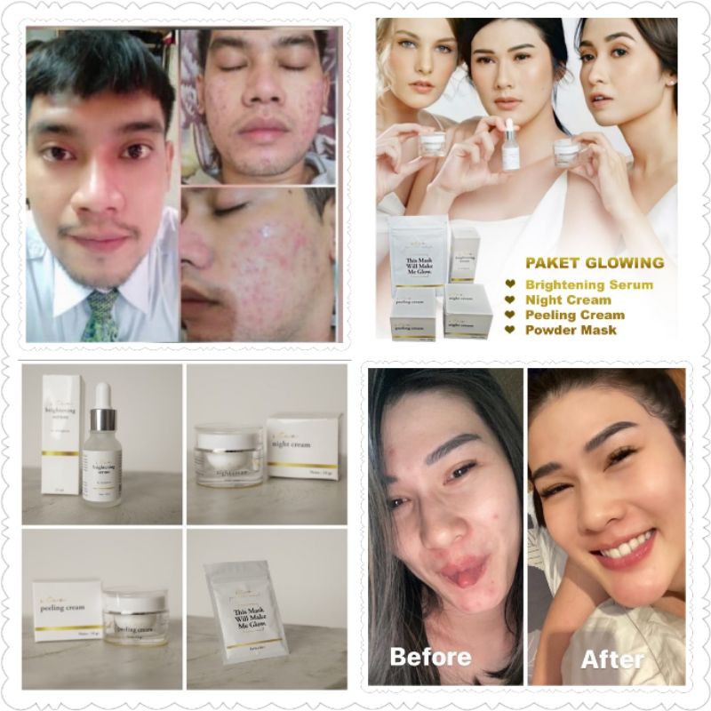 STEV Skincare by STEVIE AGNECIA Paket Glowing Kecantikan Memutihkan BPOM HALAL AMAN ORIGINAL good ok