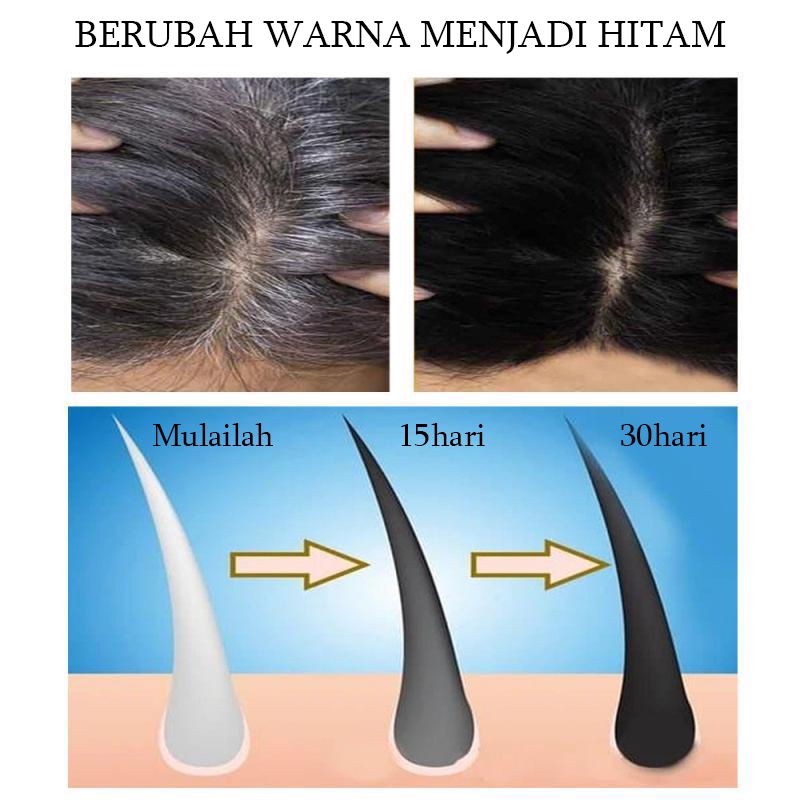 Hitam spray Hair growth serum spray Anti tonik rambut rontok Pertumbuhan rambut cepat 100ml Rambut putih tercepat di Indonesia menjadi rambut hitam Ekstrak tumbuhan alami Rambut hitam permanen