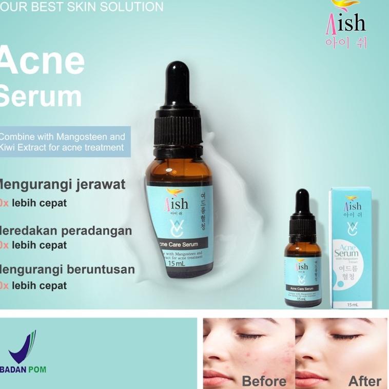 Best SERUM AISH KOREA | AISH SERUM ORIGINAL | SERUM AISH ORIGINAL | AISH SERUM KOREA BPOM / ACNE  10