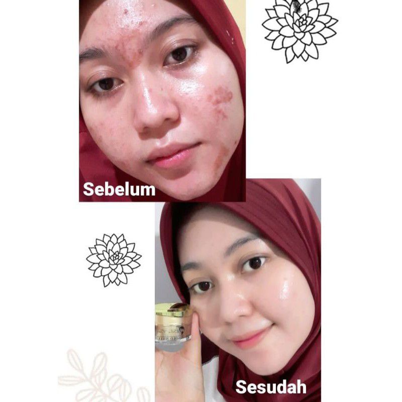 Gold jelly kedasbeauty original (kemasan baru) / GOLDJELLY KEDASBEAUTY Free SOUVENIR-6