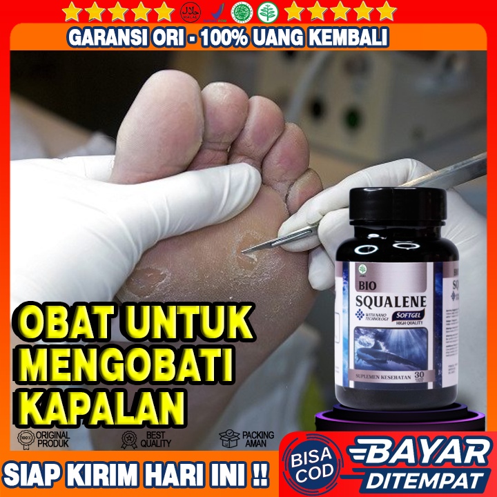Obat Kapalan - Obat Kapalan Di Kaki - Obat Kapalan Di Tanganm - Obat Penghilang Kapalan Di Kaki -  O