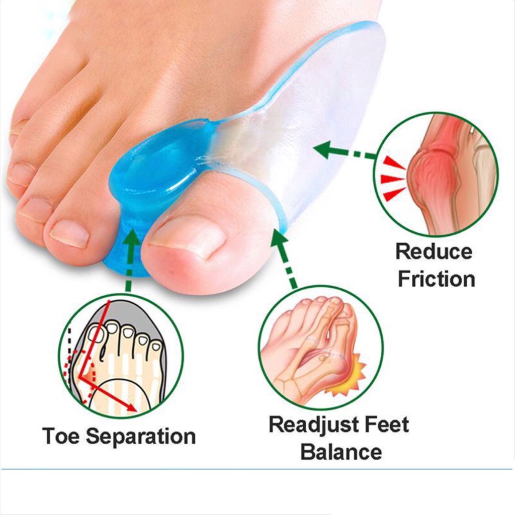 Pelindung Jempol Kaki Bahan Silikon - Bunion - 1 Pasang