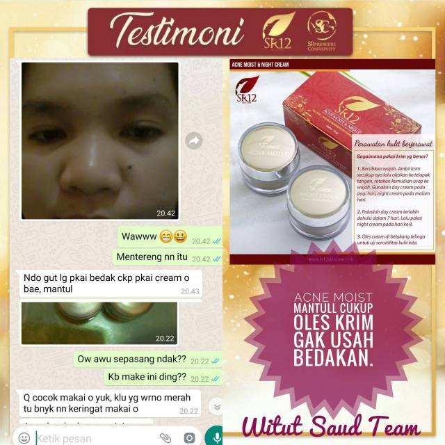 Acne Moist Cream SR12 Krim Jerawat Sedang dan Beruntus