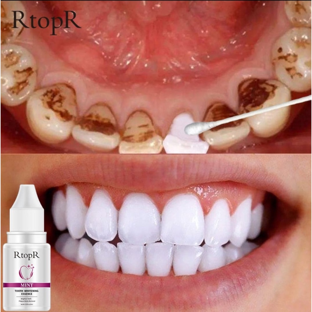 RtopR TOOTH WHITENING ESSENCE / PEMUTIH GIGI