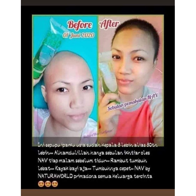 Natura Aloe Vera Shooting Gel 100% Oryginal Member Resmi Natura World beauty