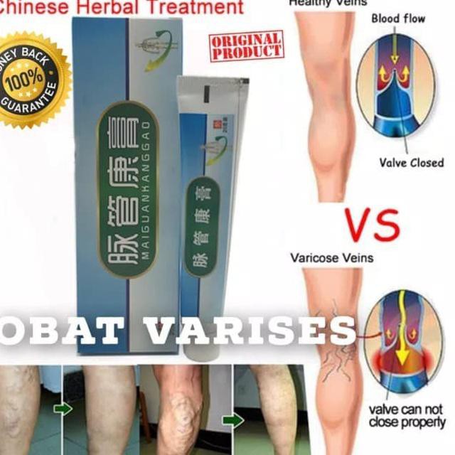 Import Obat Salep Varises / Penghilang Varises Kaki / Original Import Original