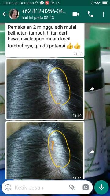 Atasi Uban Membandel Dengan Perawatan Rambut Herbal Sari Ulin