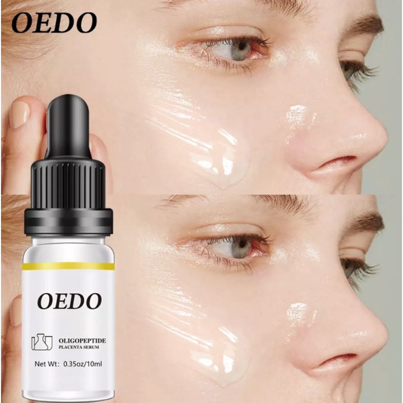 OEDO OLIGOPEPTIDE PLACENTA SERUM FACE CREAM ACNE TREATMENT SKIN CARE REPAIR WHITENING ANTI AGING WINKLES ESSENCE