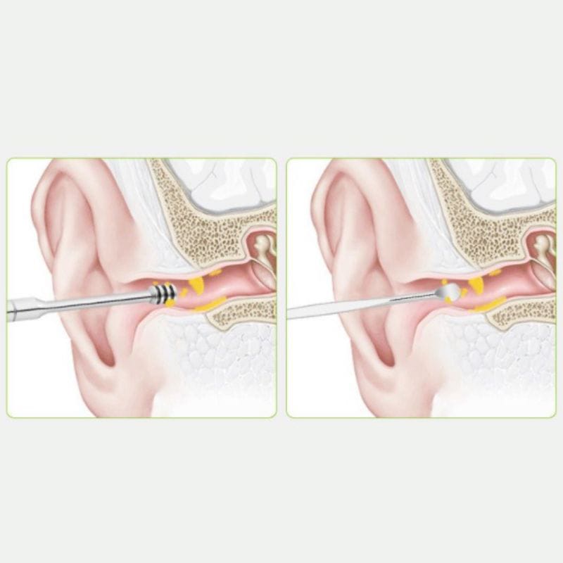 Alat pembersih telinga 6in1