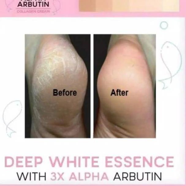 [COD] Krim Pemutih Badan Alpha Arbutin 3Plus Deep Essence Whitening Collagen Cream - BPOM 100% Original