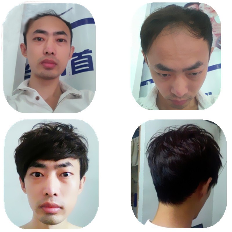 Wig Rambut  Asli untuk Kepala Bagian  Depan  Pria Shopee 