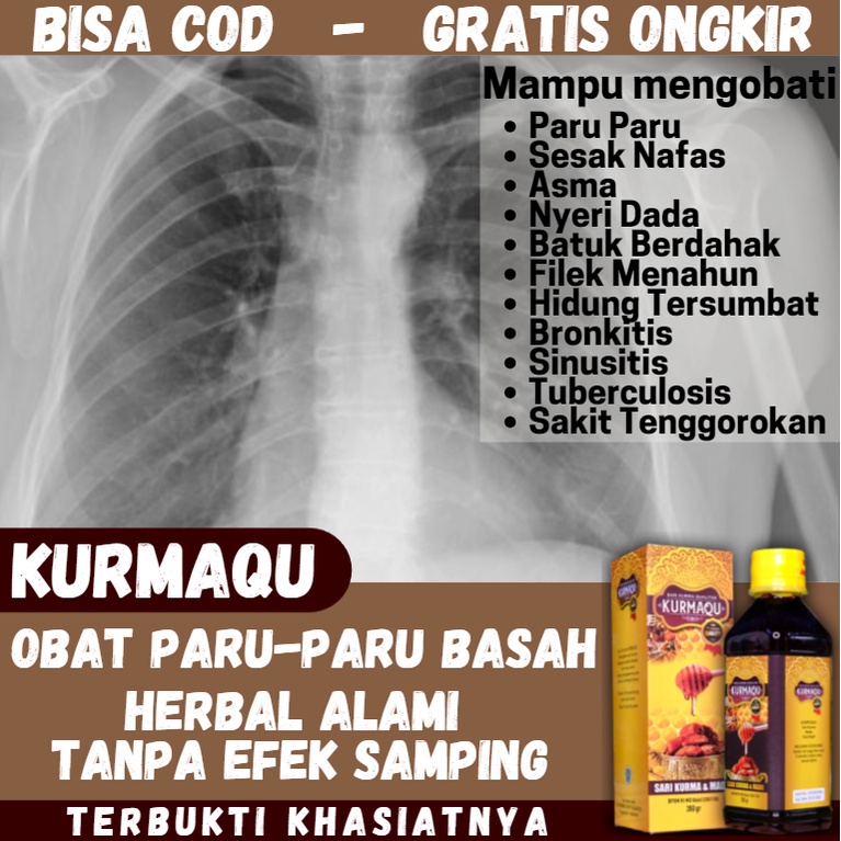 Jual Obat Herbal Paru Paru Sesak Nafas Radang Paru2 Alami Flek Infeksi ...