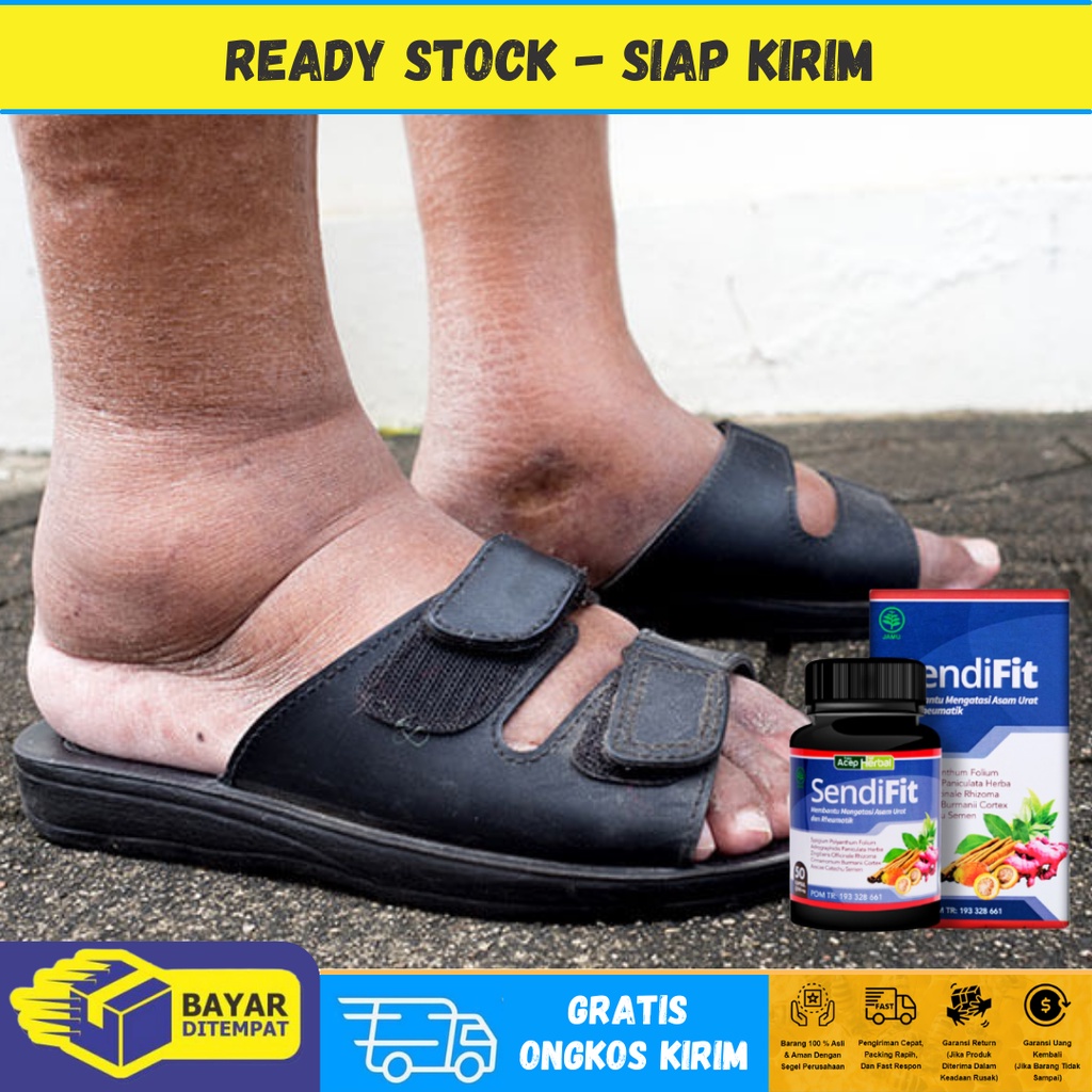 Obat Kaki Bengkak Asam Urat, Obat Pergelangan Kaki Sakit Bengkak, Obat Pegal Kaki dan Betis, Obat Ny