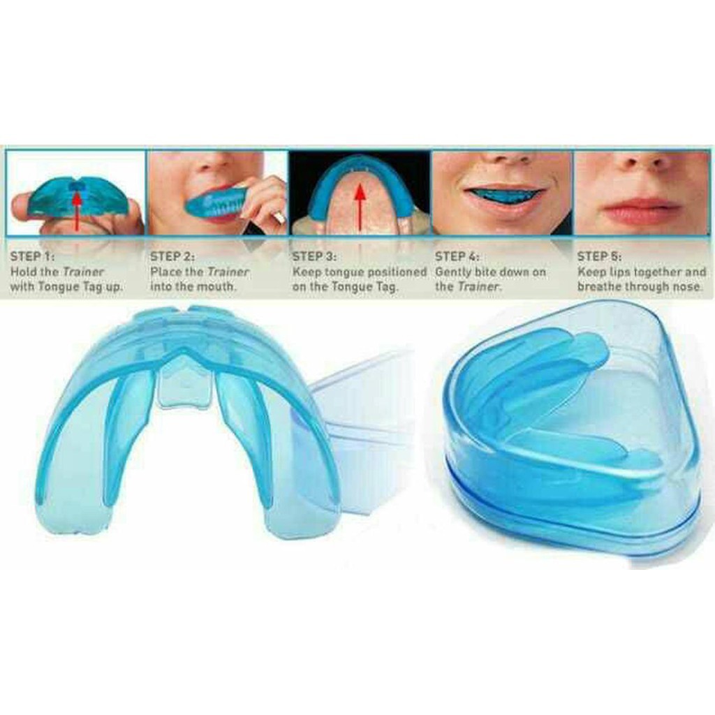 [BIRU] Perapi Gigi Tanpa Behel dari Bahan Silikon Bukan Kawat l Orthodentic Retainer Teeth Phase 1