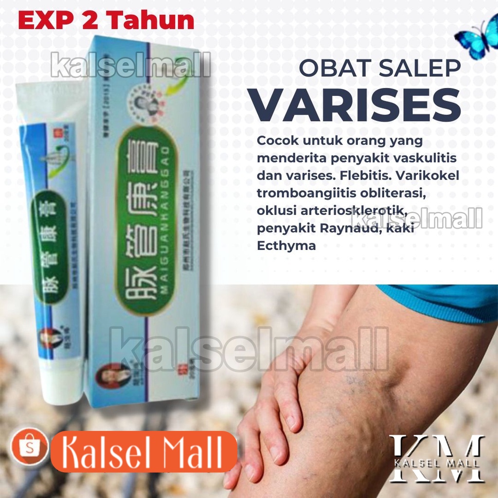 Obat Salep Krim Cream Penghilang Varises Paises Herbal Aman 100% ORIGINAL Maiguankanggao Salap Cina Herbal Tanpa Efek Samping Varicose Veins  Parises Ampuh China Untuk Pengobatan Varises Kaki Tangan Badan Kulit Pegal - Pegal OC4