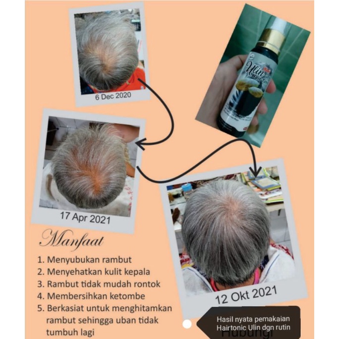 ULIN HAIR TONIC BY KALIS PERAWATAN RAMBUT ALAMI HAIR OIL PENYUBUR PENUMBUH PENGHITAM RAMBUT NATURAL