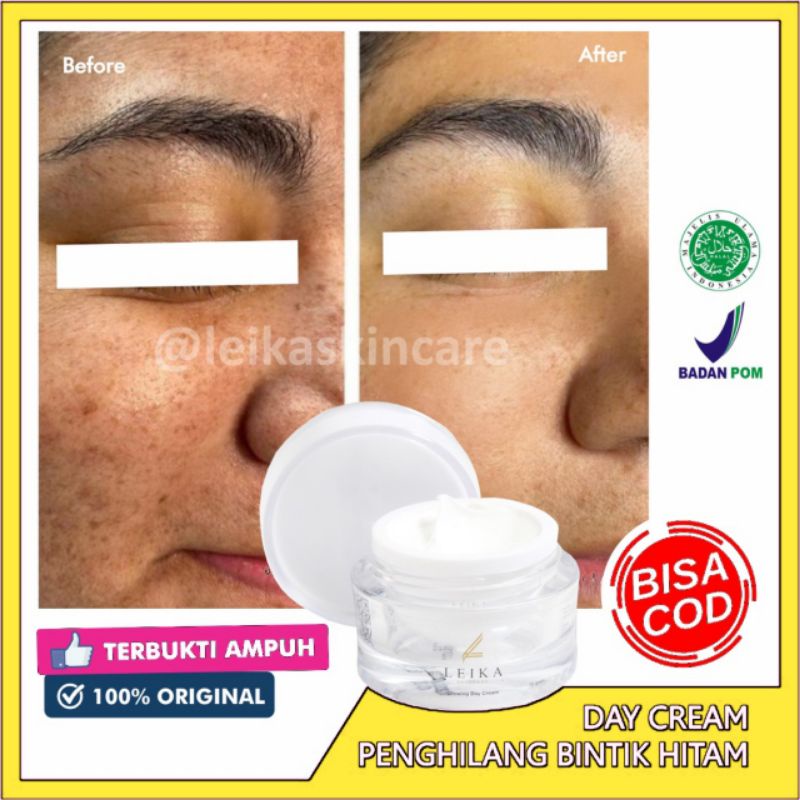 Ampuh permanen penghilang bintik hitam di wajah penghilang noda hitam di wajah penghilang flek hitam