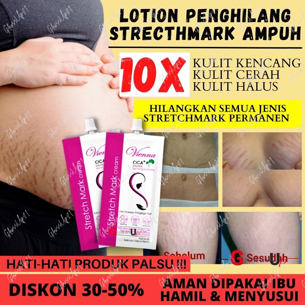 PENGHILANG STRECHMARK VIENNA STRETCH MARK CREAM 30ML SACHET - CREAM SELULIT - STRETCHMARK CREAM