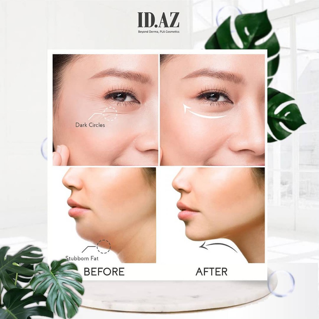 (TERBARU) PENGHILANG KANTUNG MATA INSTAN DAN PENGHILANG KERIPUT DI WAJAH FACE FIT T ID AZ