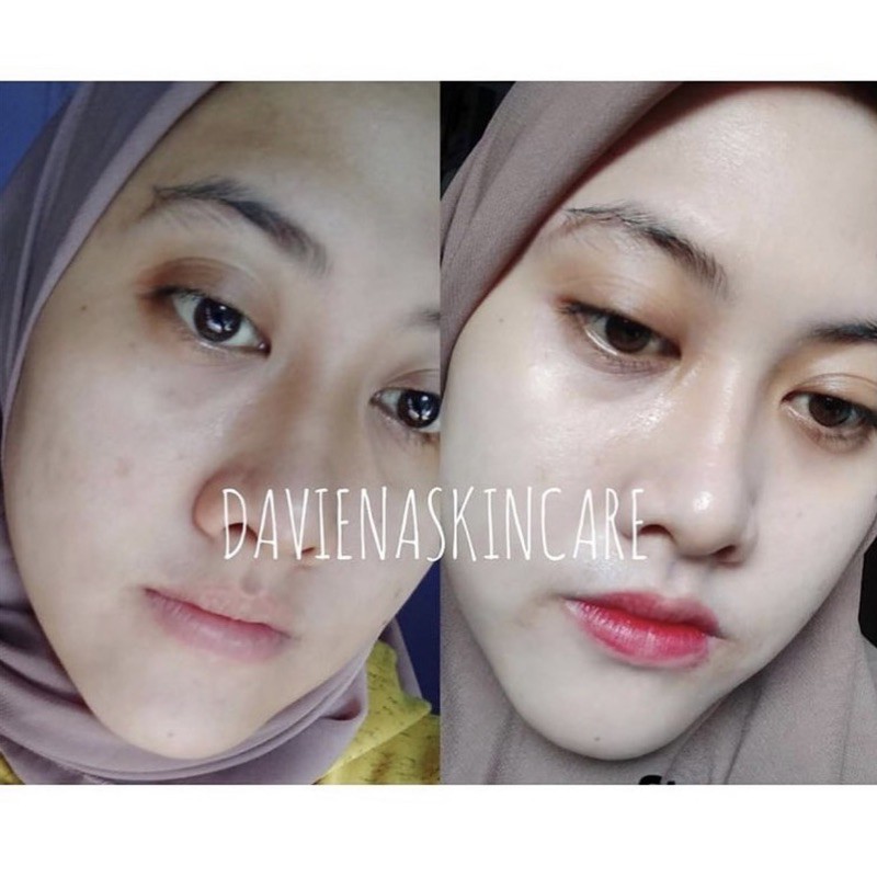 GLOWING / WHITENING SERIES DAVIENA SKINCARE