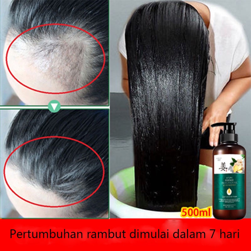 Sampo Jahe  Sampo Anti Rambut Rontok  Shampo 280g Ekstrak Jahe Alami Untuk Memperbaiki Kulit Kepala Anti Rambut Rontok