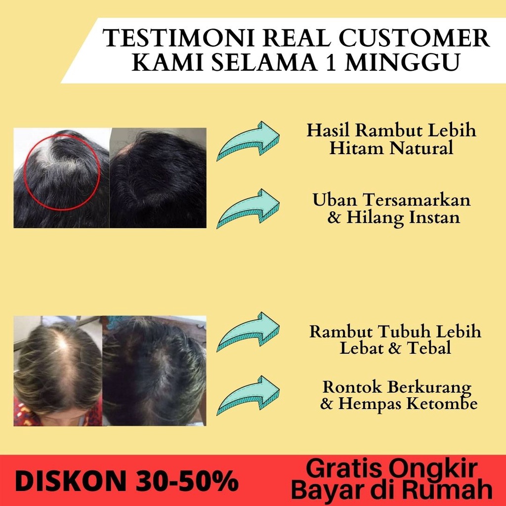 SAMPO PENGHITAM RAMBUT UBAN HAPPY SHAMPOO KEMIRIKU 100ML SHAMPO PENGHILANG KETOMBE TREATMENT RAMBUT