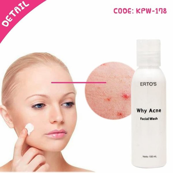 [ORI] Why Acne Facial Wash | Sabun Pembersih Muka untuk Wajah Berjerawat Ampuh dalam 14 Hari