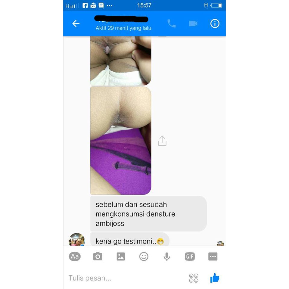 Ambejoss Obat Herbal Ambeien Wasir De Nature Stadium 1 - 4 Herbal ORIGINAL 100%  DENATURE OFFICIAL INDONESIA-7