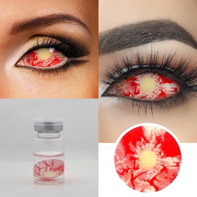 Freshlady: Patient Zero Sclera Lens
