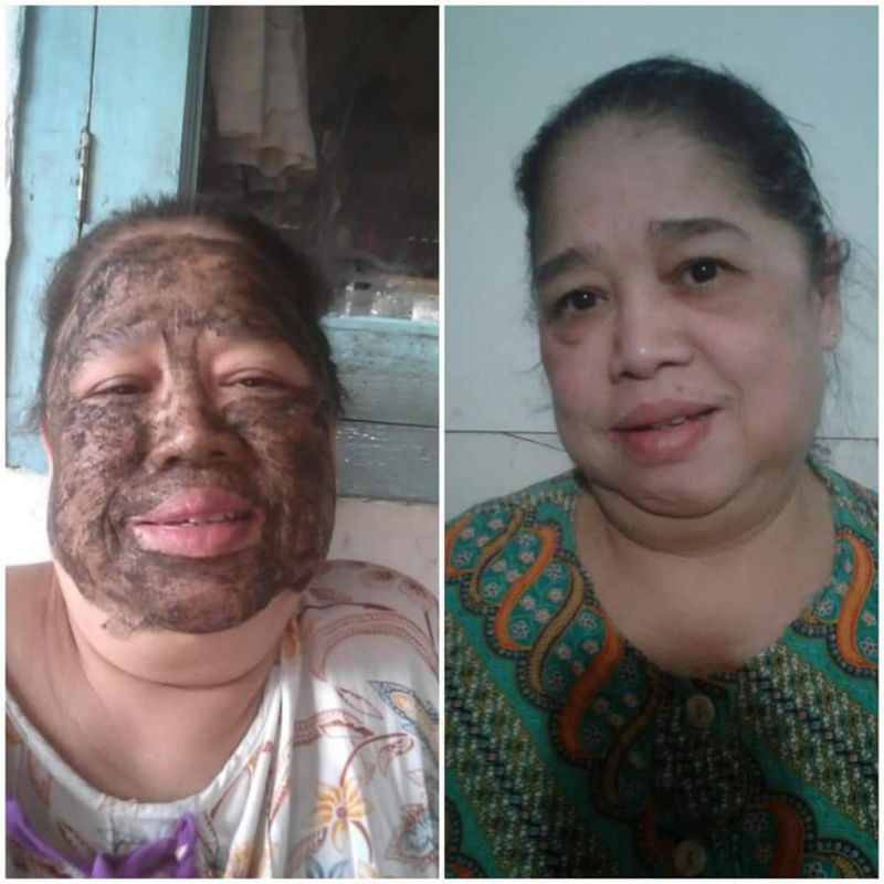 BEDAK LOTONG/SCRUB WAJAH/SCRUB BADAN/LULUR HITAM WAHDAH