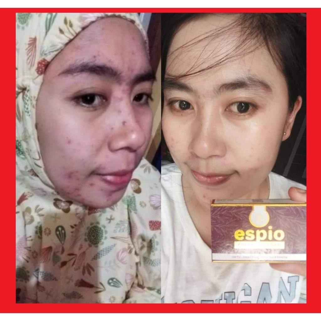 promo [ BISA COD ] Espio Terlaris Sabun Collagen Memutihkan Kulit Wajah &amp; Seluruh Badan