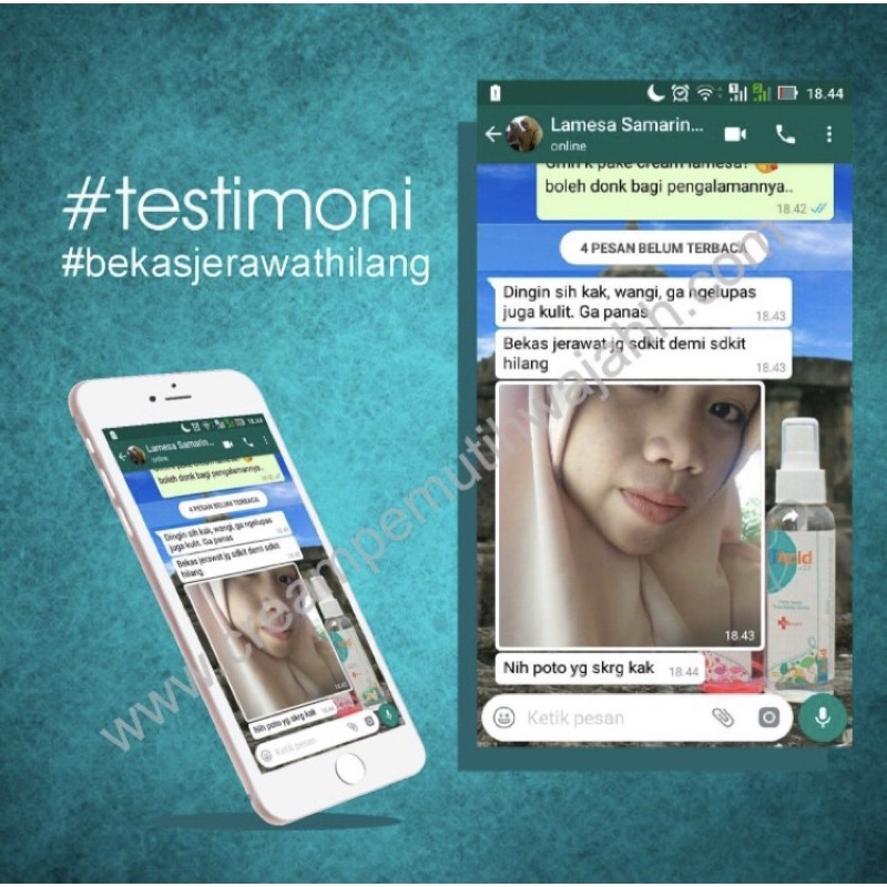 Lamesa Cream Pemutih Wajah Premium Aman buat Bumil dan Busui