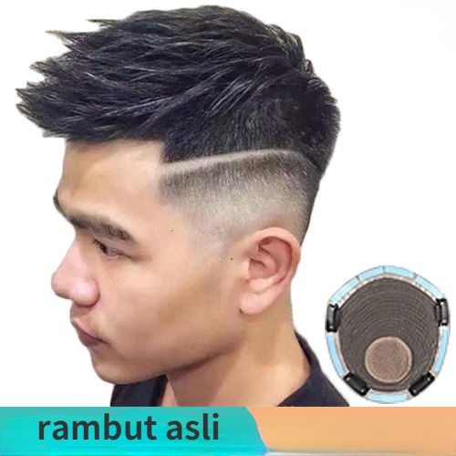Patch pengganti versi Korea dari pria tampan wig pesawat kepala patch tak terlihat dahi patch dahi k
