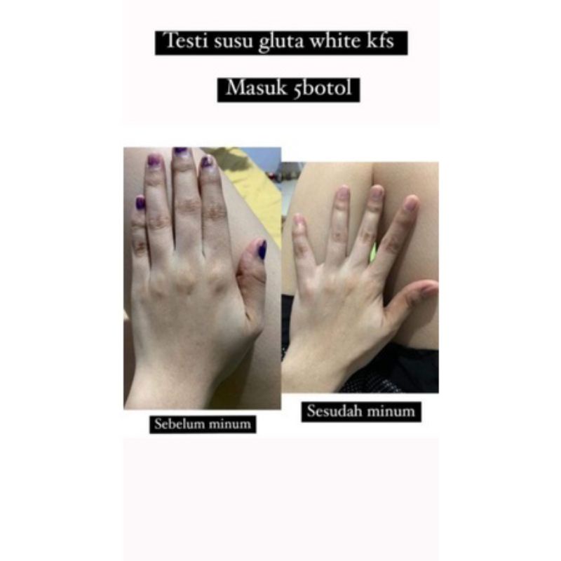 SUSU GLUTA WHITE KSF