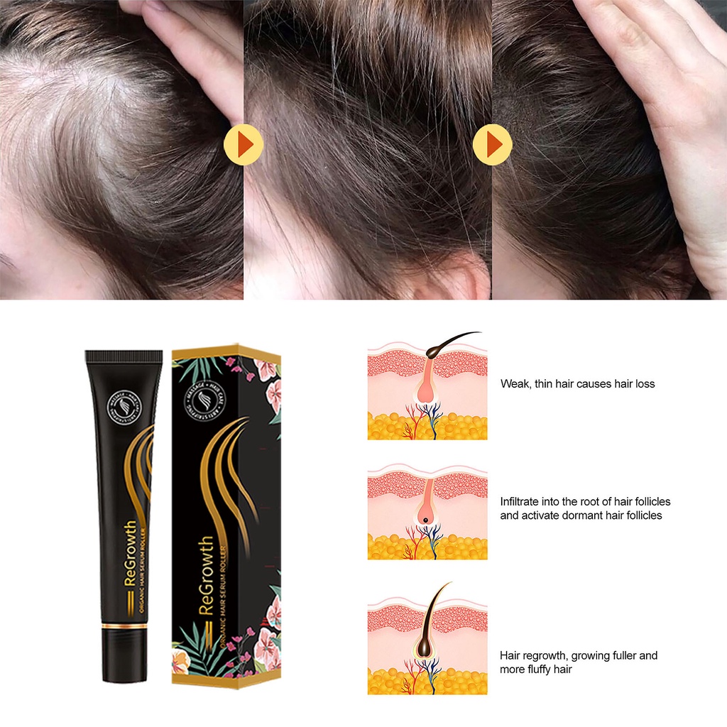 REGROWTH ORGANIC HAIR SERUM ROLLER / SERUM PENUMBUH RAMBUT BOTAK DAN RONTOK