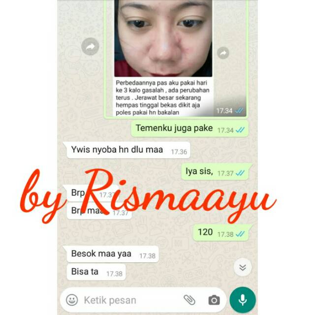 Real testi HN Original by Rismaayu, buruan order asli no kw bisa cek barang saat sudah sampai yaaaaa