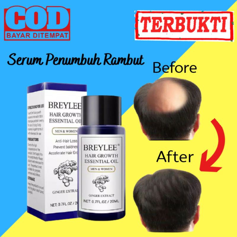 Serum Penumbuh Rambut Kepala Botak Melebatkan Rambut