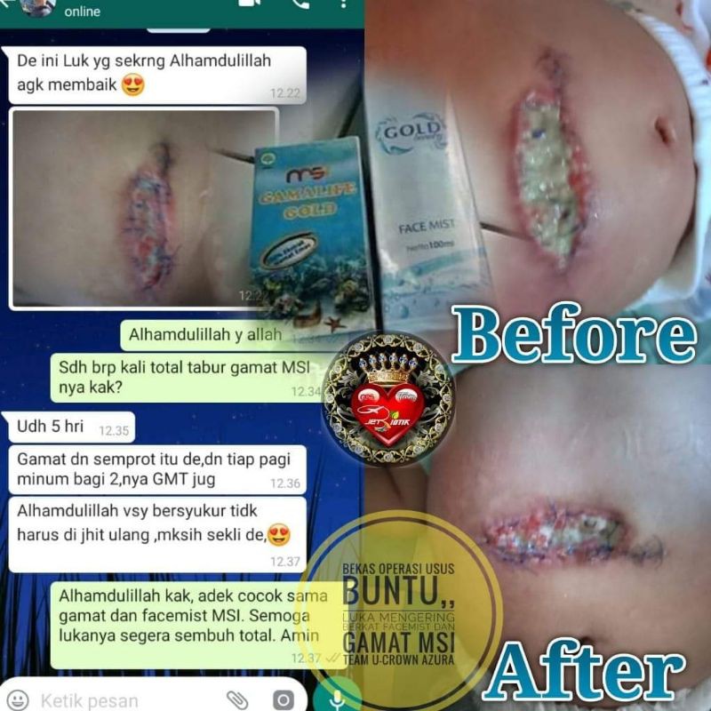 Gamat gold Msi ori ecer dan paket kemasan terbaru