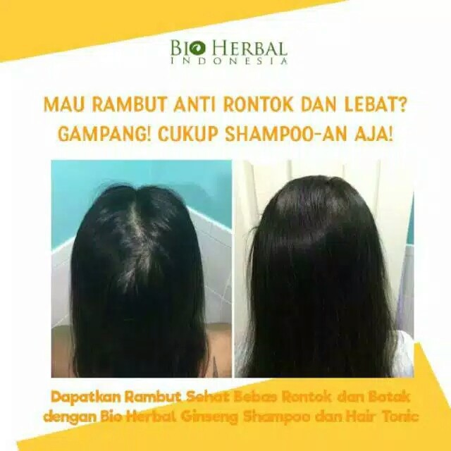 ✨ AKU MURAH ✨Bio Herbal Hair Tonic/ Bio Herbal Ginseng Hair Tonic BPOM