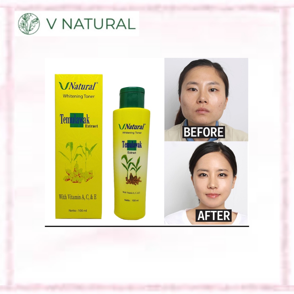 VNatural / V Natural Whitening Toner Temulawak 100ml (official-100% original)