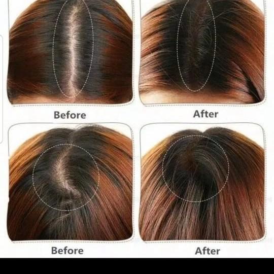 Hair shadow powder Sevich / Penutup uban / Hair line shadow