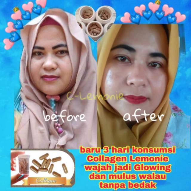 [ BISA COD ] TERMURAH ECER COLLAGEN C-LEMONIE D'LEMONIE DLEMONIE BPOM