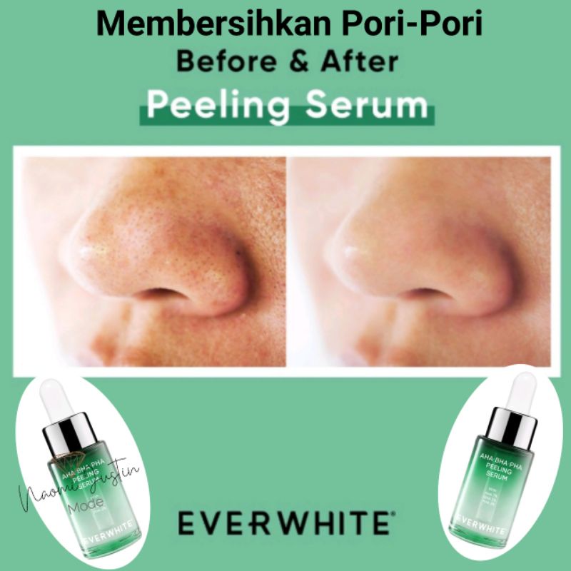 Everwhite AHA BHA PHA Peeling Serum (Membersihkan Pori-Pori wajah)